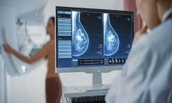 Female doctor looks at breast screening