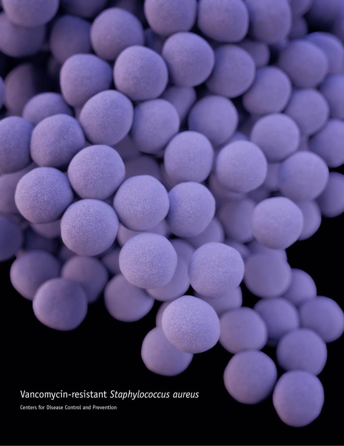 Staphylococcus aureus