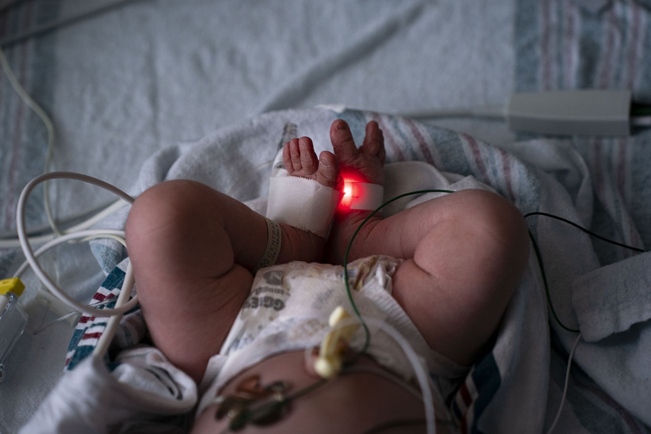 A baby's feet at a hospital. 