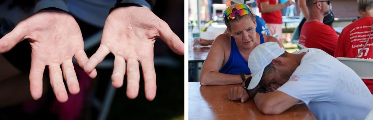 A collage of photos shows a close-up of blistered hands and a woman comforting a man who rests his head on a table