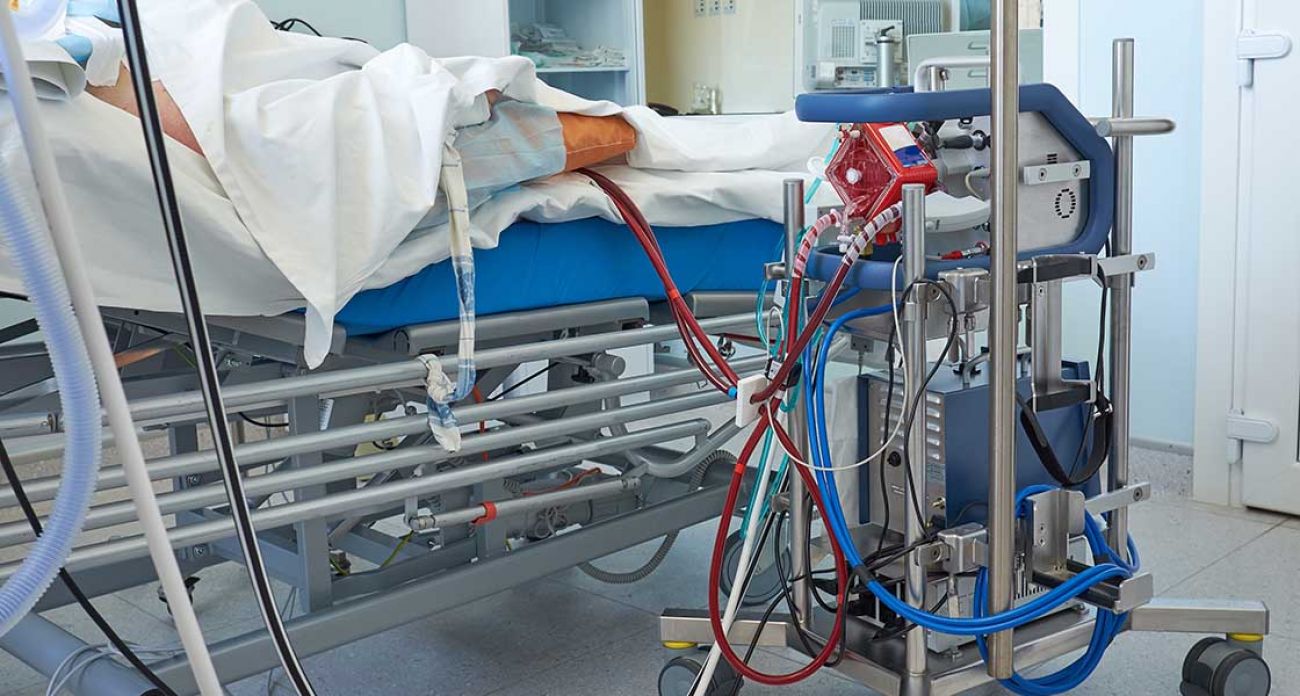 An ECMO machine