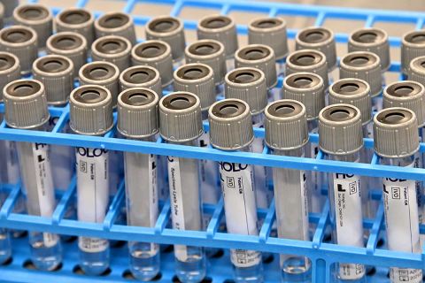 variant test tubes