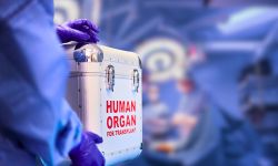 This image shows a medical professional wearing purple gloves holding a sterile transport box labeled "Human Organ for Transplant." The background appears to be a blurred surgical or medical facility.